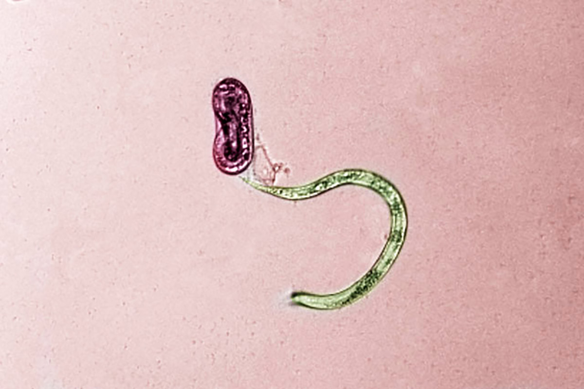 Microscopic image of two juvenile guava root-knot nematodes (GRKN), one newly hatched and one unhatched. Image colorized. Photo by William Rutter, USDA-ARS.
