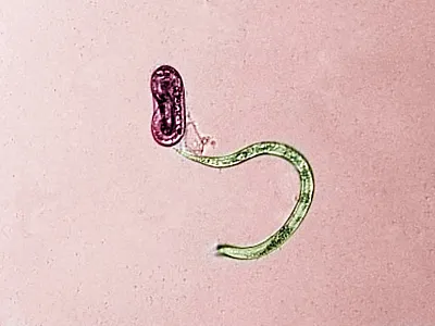 Microscopic image of two juvenile guava root-knot nematodes (GRKN), one newly hatched and one unhatched. Image colorized. Photo by William Rutter, USDA-ARS.